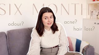 Six Months Off The Pill... ALL The Changes I've Experienced | Lucy Moon
