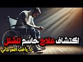 اكتشاف علاج حاسم للشلل لأول مرة