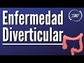 Enfermedad Diverticular Explicada Claramente