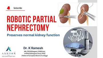 Robotic Partial Nephrectomy| Dr. K Ramesh Urologist, Uro-oncologist&Robotic surgeon #apollohospitals