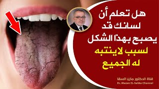 خطرقد يداهمك فجأة يخرب الجسم ويسبب الالتهابات والتقرحات هذه أفضل طرق الوقاية والعلاج من الفطريات