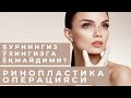 Бурнингиз ўзингизга ёқмайдими? Ринопластика операцияси.