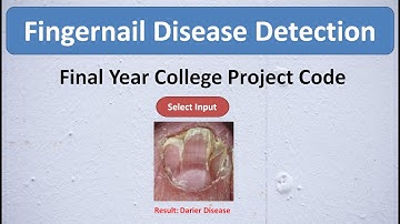 Fingernail Disease Detection Using Deep Learning CNN | Image Processing Matlab Project Code