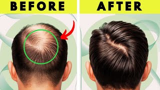 10 PROVEN Tips to Make Hair Grow FAST (for Men and Women) - 🚫 NO Surgery!