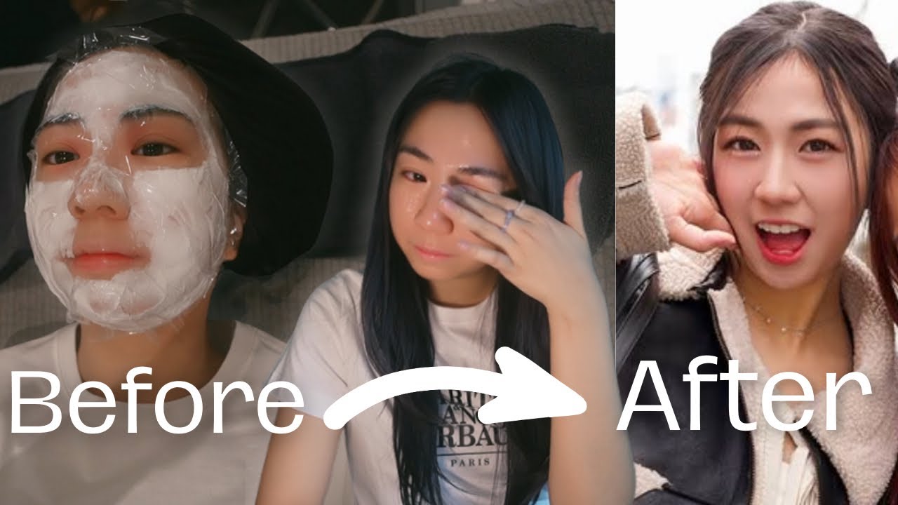 glow up in korea + a crisis 😰 skin treatments, traptox, hair perm, 1 day veneers (Illit's doctor?!)