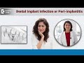 Prevent DENTAL IMPLANT INFECTION |Prevent &amp; Treat Peri-implantitis - Dr.Aditi Garg | Doctors’ Circle