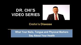Dr Chi's Fingernail and Tongue Analysis - Crohn's Disease Dr Chi S Video Series Cracks On The Tongue