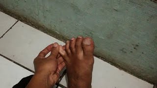 Pijat tradisional kaki
