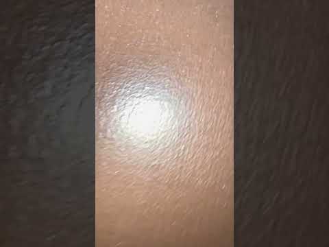   7 6 25
