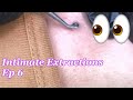 Intimate Extractions Ep 6 | BK Beauty Spa