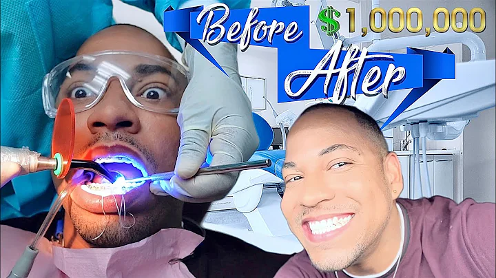 I PAID $1,000,000 FOR NEW TEETH | QUITE PERRY