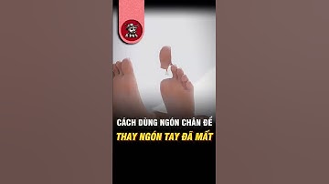 Mất Ngón Tay Cái? Có Thể Được Thay Bằng Ngón Chân! 🩺 #shorts #kiếnsĩ