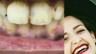 Ilkaani Keessan Kan Diimatu Fi Isin Dhukkubuf Dawaa Kinoo