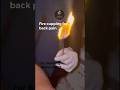 Fire cupping  #aeternum