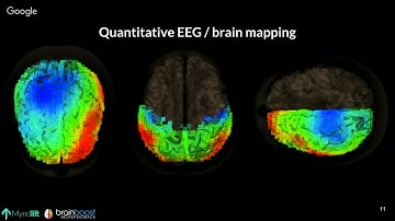 Fundamentals of Neurofeedback [Webinar]