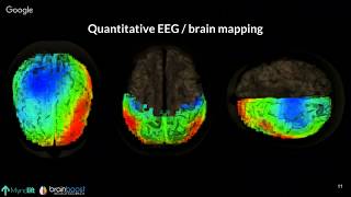 Fundamentals of Neurofeedback [Webinar]