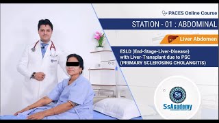 Paces 2023 New Format Station - 01 End-Stage - Liver - Disease With Liver-Transplant Due To Psc