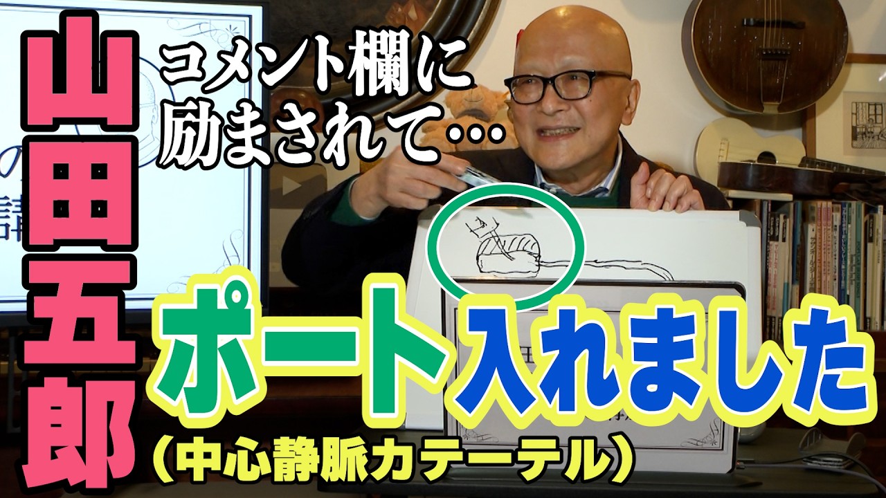 【原発不明がん治療報告】山田五郎、ポート入れました【中心静脈カテーテル】