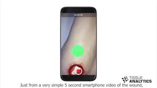 3D Wound Imaging on a Smartphone screenshot 1