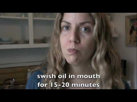 Get White Teeth &amp; Healthy Gums Naturally- Oil Pulling, Ep157 - YouTube