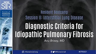 Diagnostic Criteria for Idiopathic Pulmonary Fibrosis