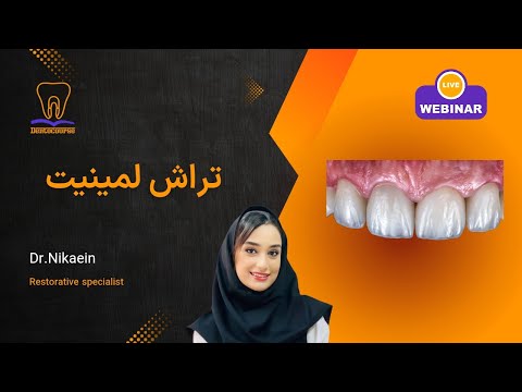 تراش و آماده سازی دندان برای لمینیت