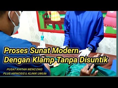 Proses Sunat Klamp Tanpa Suntik Cepat Hanya 10 Menit