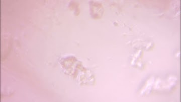 PCR test, 2500X magnification, on the tip of the PCR test.