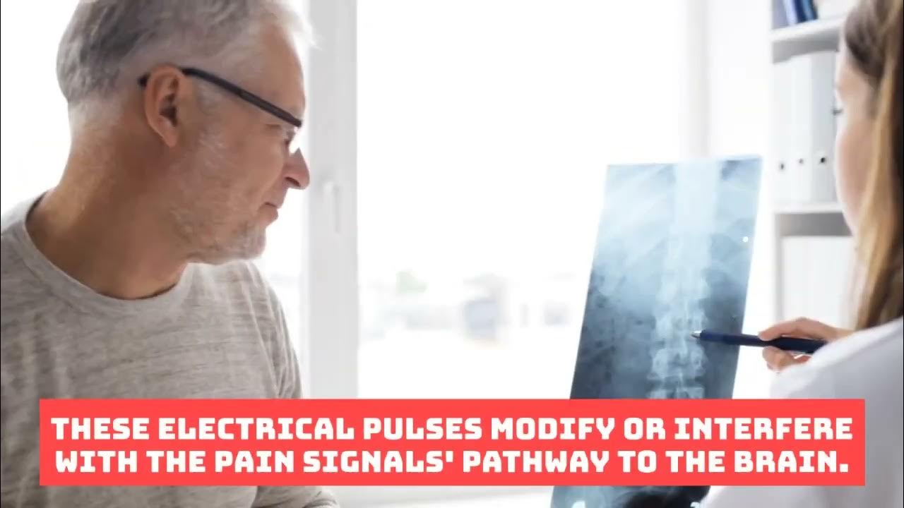 How does spinal cord stimulator work? YouTube