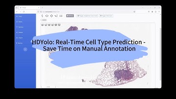 I-Viewer HD-Yolo Tutorial: Real-time Nuclei Classification and Segmentation