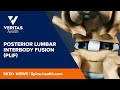 Posterior Lumbar Interbody Fusion (PLIF)