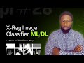 X-Ray Image Classification — Machine Learning Made Easy!