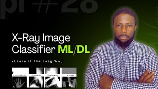 X-Ray Image Classification — Machine Learning Made Easy!