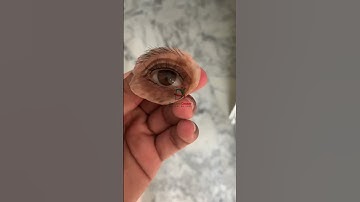 Silicone orbital prosthesis. #artificialeye #anaplastology #blackfungus #orbitalprosthesis