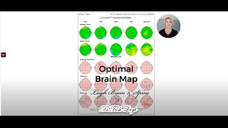 How to Interpret Your qEEG Brain Map.