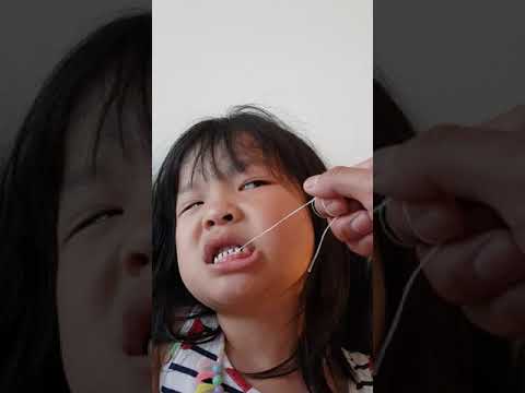 Video: Hur Man Framkallar En Söt Tand