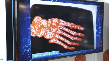 Cadence Demonstration of Real-time Visual SLAM for Embedded Devices