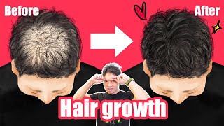 [Hair growth] Incredible self-massage! (By acupuncturist specialized in thin hair) 抜け毛予防マッサージ