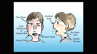 Oral Posture/Body Posture/Buteyko Breathing/Orthotropics/Mewing