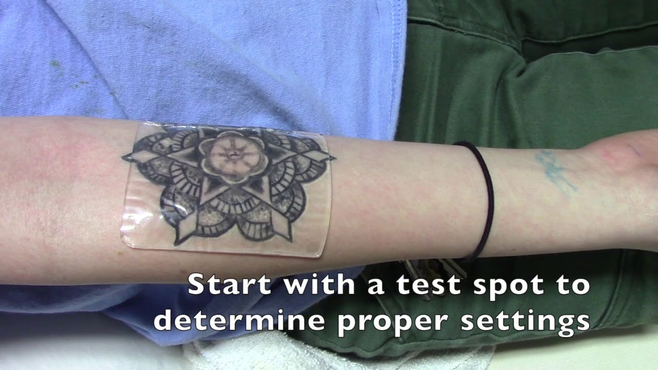 Laser Tattoo Removal with The Describe PFD Patch  YouTube