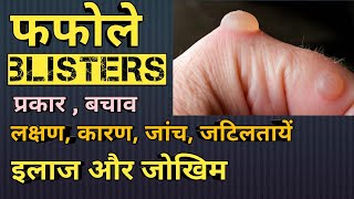 फफोला (तरल पदार्थ से भरा हुआ त्वचा का एक उभार) || Blisters explained in Hindi || Medhealth support screenshot 3