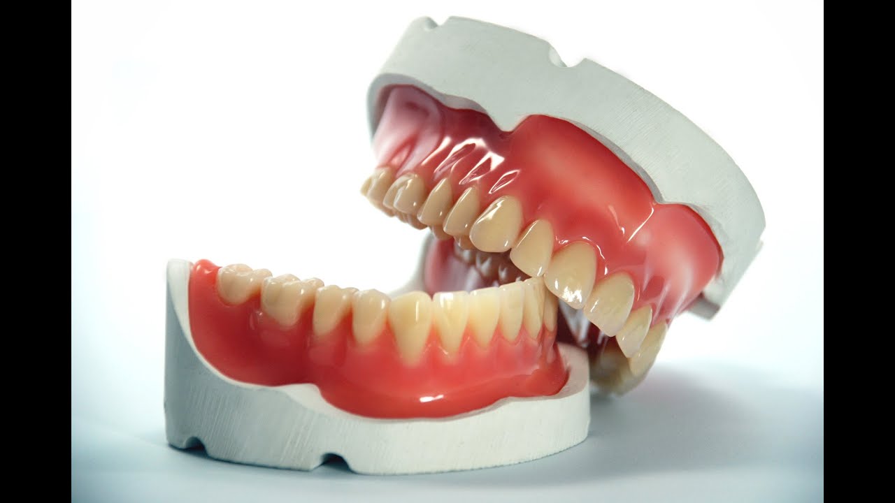 Zahn zu Tode behandelt - Arztfehler?