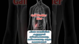 Gall bladder stone diet  | പിത്ത സഞ്ചിയിൽ കല്ലുള്ളവർ ഒഴിവാക്കേണ്ടതും കഴിക്കേണ്ടതും ആയ ഭക്ഷണങ്ങൾ
