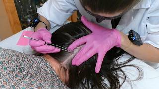 ASMR School Nurse LICE Check on Scalp and Neck | Lice Removal with a Comb and Tweezers (Real Person)