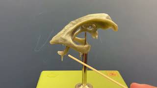 Ventricles of the Brain - Cast Model