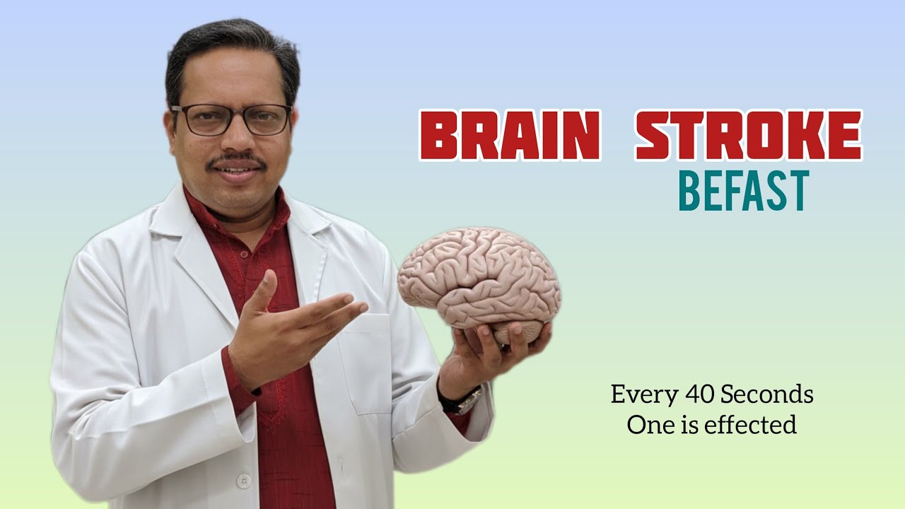 Brain Stroke | Dr. Sam JRC,MD,DM Neurologist | TV interview 
