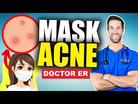 MASKNE! How to Get Rid of Mask Acne in One Week | Doctor ER
