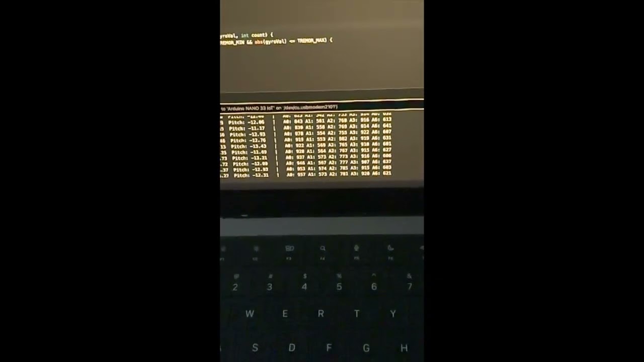 Tremor Glove Algorithm Demo