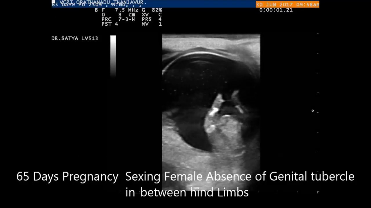 Glimpse of Basic Ultrasound Clips in Bovine Reproduction - TANUVAS VCRI Orathanadu