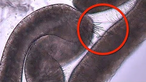 Jellyfish Stinging in MICROSCOPIC SLOW MOTION - Smarter Every Day 120